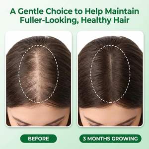 เซรั่มบำรุงหนังศีรษะและเร่งผมยาว 2-IN-1 สูตรสดชื่นด้วยโรสแมรี่ ไนอะซินาไมด์ กรดอะมิโน ขิง ไบโอติน และน้ำมันละหุ่ง - Product Image 2