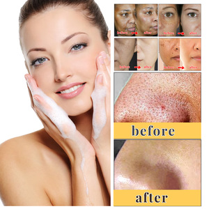 สบู่โคจิกแอซิดสมุนไพร สูตรบำรุงผิวขาว ลดสิว ใช้ได้ทุกวัน สำหรับขายส่ง - Product Image 5