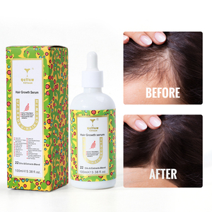 Logo privé Promouvoir la repousse des cheveux et Anti-perte de cheveux Sérum de croissance <span class=keywords><strong>tonique</strong></span> naturel à la biotine 60ML /100ML - Product Image 3