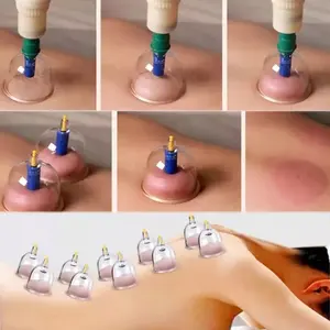 Vakuum-Schröpfset aus Kunststoff (PC, AS) Hijama-Schröpfgläser Größen 1 bis 8 als einzelne Schröpfgläser - Product Image 4