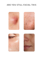 Máquina de Rejuvenecimiento Facial 4 en 1, Máquina de Belleza de Alta Frecuencia, Dispositivo de Belleza Antienvejecimiento para Lifting Facial y Tratamiento del Área de los Ojos