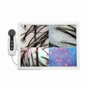 Offre Spéciale : Appareil de Détection Cutanée du Cuir Chevelu avec Affichage Comparatif sur <span class=keywords><strong>4</strong></span> Écrans et Carte <span class=keywords><strong>Mémoire</strong></span> Grande Capacité - Product Image 6