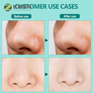 Nhãn hiệu riêng tre tự nhiên Than mũi lỗ chân lông băng làm sạch sâu loại bỏ mụn đầu đen mũi dải - Product Image 4