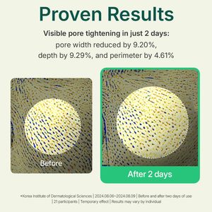 แป้งโปร่งแสงมาเดก้า เฮอร์เบิล ทีทรี เอซี ออยล์ คอนโทรล สำหรับผิวมัน - Product Image 3