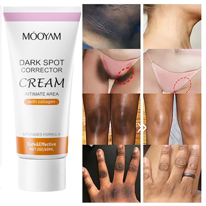 MOOYAM Marque privée <span class=keywords><strong>Crème</strong></span> correctrice pour les taches brunes sur la <span class=keywords><strong>zone</strong></span> <span class=keywords><strong>intime</strong></span>, blanchissante et nourrissante, au collagène, sûre et efficace, 60g - Product Image 5