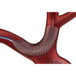 Tube en alliage <span class=keywords><strong>NiTi</strong></span> pour stent cardiaque et périphérique - Tube en Nitinol à haute résistance à la fatigue, matériau pour dispositifs TAVR/PFA - Product Image 1