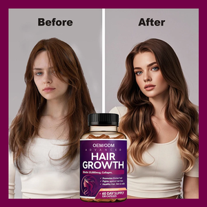 من مصنع تصنيع المعدات الأصلية فيتامينات لنمو الشعر للنساء بيتين لتغطية الشعر السميك وفروة الرأس كبسولات لنمو الشعر للنساء - Product Image 5