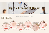 Creme facial de remoção de cicatrizes, creme anti acne para clareamento e hidratação facial