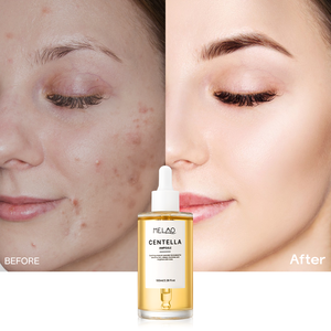 Ampolla de Centella OEM esencia sensible para el cuidado de la piel brillo facial niacinamida calmante enrojecimiento centella asiática suero - Product Image 1