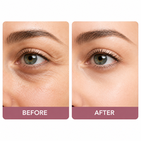 Sérum Contour des Yeux au Rétinol en Roll-on 10ml avec Caféine pour Cernes, Poches et Ridules – Hydratant, Marque Blanche, OEM, ODM, Logo Personnalisé