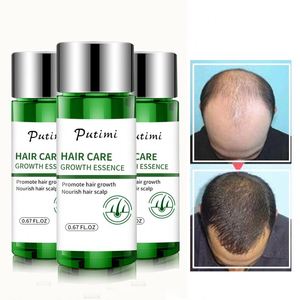 Putimi Fast Essence Shampooing <span class=keywords><strong>Anti</strong></span>-Chute pour Hommes et Femmes, Sérum de Croissance Capillaire Préventif - Product Image 3