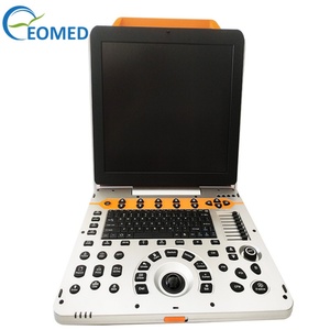 Escáner de Ultrasonido Médico de Alta Resolución EO-P60, Sistema de Diagnóstico por Ultrasonido Doppler Color Portátil - Product Image 4