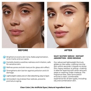Suero Facial Coreano Hidratante con Niacinamida y Centella Asiática para un Tono de Piel Uniforme con Ácido Tranexámico, ODM OEM - Product Image 5