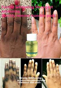 Sérum pour le visage anti-taches sombres, <span class=keywords><strong>vitamine</strong></span> C, escargot, <span class=keywords><strong>acide</strong></span> hyaluronique, niacinamide, sérum pour le visage, cosmétiques, fourniture d'usine - Product Image 2