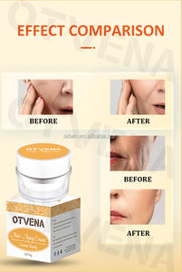Crème anti-âge OTVENA cliniquement testée avec effet raffermissant instantané, réduit les rides d'expression, les taches de vieillesse, formule naturelle à base de plantes - Product Image 6