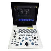 SY-AX50-1 Appareil d'échographie médicale USG le plus populaire pour la grossesse, scanner ultrasonore médical gynécologique portable