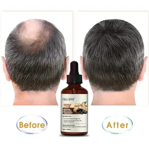 NUSPA özel etiket bitkisel organik Vegan Anti saç dökülmesi tedavisi saç büyüme yağı kel saç