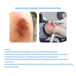 แผ่นปิดแผลซิลิโคนโฟมแบบดูดซับสูงพร้อมขอบ ช่วยรักษาความชื้นและเร่งการสมานแผลได้ดีเยี่ยม - Product Image 4