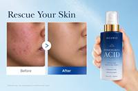 Spray apaisant après-soleil à l'acide hypochloreux hydratant en profondeur pour le corps, soin quotidien, réparation, brume rafraîchissante sans parfum pour le visage, avec logo personnalisé