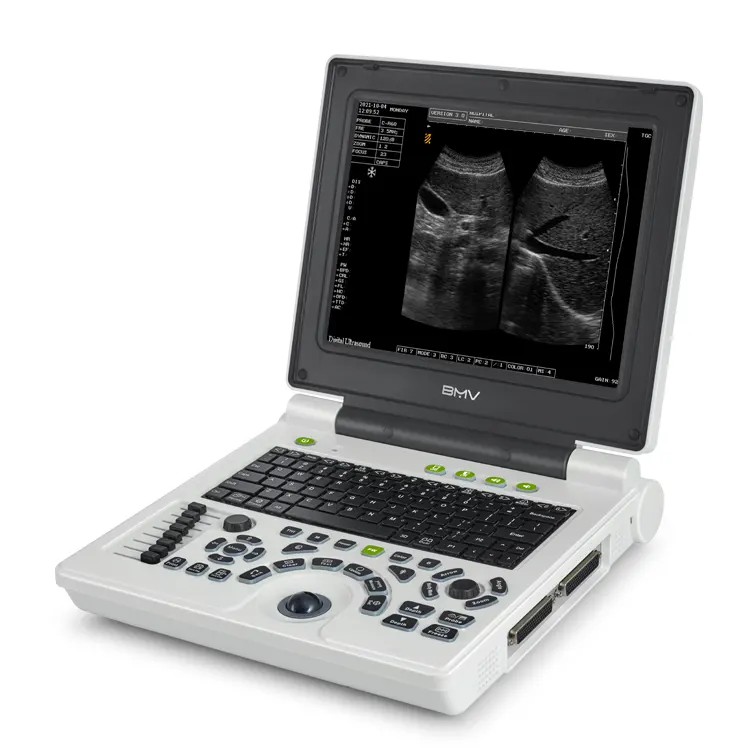 BMV BPU21A Best Sells B/W Dispositivos de diagnóstico ultrasónico Precio de la máquina de escaneo de ultrasonido portátil