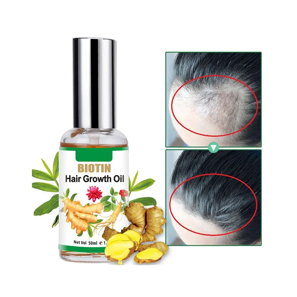 Etiqueta Privada ingredientes de plantas orgánicas naturales detiene la caída del cabello, tratamiento de adelgazamiento del cabello aceite para el crecimiento del cabello