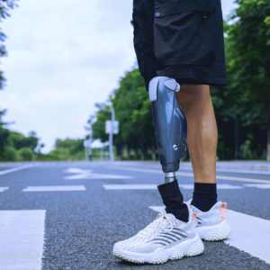 Joelho Protético Inteligente com IA e Controle Anti-Trocapeço, Articulação Avançada para Amputados Transfemorais AK - Product Image 2