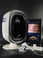 Máquina portátil de análisis de piel, máquina de análisis de piel Visia, máquina de análisis de cuero cabelludo, conexión móvil