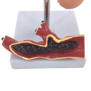 Анатомические модели для демонстрации диабета - Product Image 2