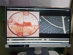 गिरी पूर्ण HD कैमरा पोर्टेबल ऑप्टिकल वीडियो colposcope कीमत चिकित्सा डिवाइस kn2200b योनि योनिभित्तिदर्शन मशीन उपकरण - Product Image 5