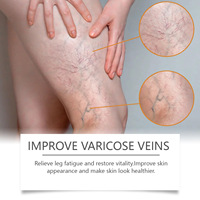 Crème hydratante à base de plantes pour le soin des varices, soulage la fatigue des jambes et le stress, application corporelle