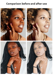 <span class=keywords><strong>Crème</strong></span> <span class=keywords><strong>Visage</strong></span> Diamant à la Vitamine C Naturelle Bio Éclaircit, Illumine la Peau et Réduit les Taches Brunes – <span class=keywords><strong>Meilleure</strong></span> <span class=keywords><strong>Crème</strong></span> Blanchissante - Product Image 5