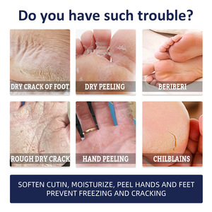 <span class=keywords><strong>Crema</strong></span> mani <span class=keywords><strong>e</strong></span> piedi nutriente, idratante <span class=keywords><strong>e</strong></span> <span class=keywords><strong>antibatterica</strong></span> con logo personalizzato - Product Image 3