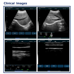 B53 giá thấp SONOSCAPE xách tay siêu âm DOPPLER Máy quét cho doanh số bán hàng - Product Image 6