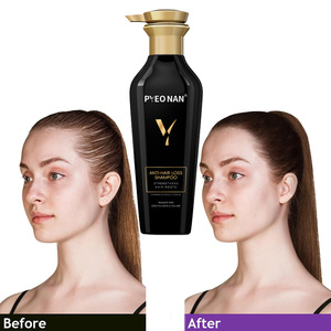 Champú Herbal Anticaspa para Cabello Graso con Queratina, <span class=keywords><strong>Biotina</strong></span>, Colágeno y Cafeína para el Crecimiento del Cabello y Contra la Caída - Product Image 1