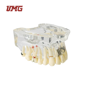 Modelo de Dientes de Práctica para Implantes Dentales UMG UM-2006, Mandíbula Inferior, para Incisión y Perforación, Calidad Superior Duradera - Product Image 2