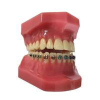 Modèle anatomique d'étude pour dentiste : dent molaire orale avec carie, maxillaire à 3 racines, pour l'enseignement et la formation