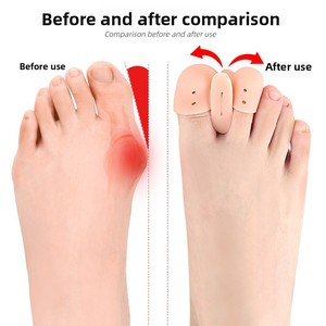 Séparateurs d'orteils en <span class=keywords><strong>silicone</strong></span> souples anti-abrasion, protège-orteils <span class=keywords><strong>pour</strong></span> <span class=keywords><strong>hallux</strong></span> <span class=keywords><strong>valgus</strong></span> et correction des orteils superposés - Product Image 6