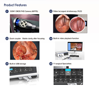 Appareil d'imagerie médicale d'endoscopie Full HD Caméra ORL laparoscopique IKEDA 9102T
