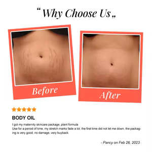 Private Label OEM Natürliche Bio-Körper massage Öl Reparatur Narbe Dehnung streifen Entfernung Öl Mutterschaft Hautpflege - Product Image 3