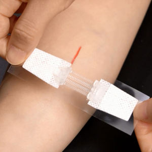 หัวเว่ยแถบปิดแผลแบบมีกาวในตัวทางการแพทย์แถบปิดแผลแบบมีแถบติดซิป - Product Image 2