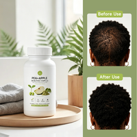 Complément nutritionnel scientifique ODM/OEM pour les problèmes de perte de cheveux chronique, comprimés de croissance capillaire à la biotine, probiotiques à mâcher