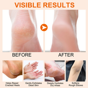 Original <span class=keywords><strong>Manuka</strong></span> mật ong Kem dưỡng ẩm chân dính <span class=keywords><strong>Manuka</strong></span> mật ong tay chân Kem dưỡng ẩm cho dưỡng ẩm sâu nuôi dưỡng - Product Image 4