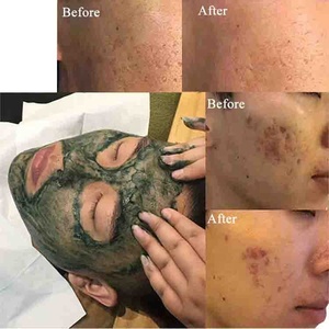 Peeling viso alle alghe verdi con logo personalizzato, etichetta privata, <span class=keywords><strong>bio</strong></span>-ago, peeling alle erbe 60%, polvere di Spongilla per Bioneedling - Product Image 2