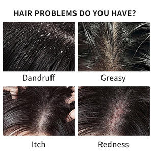 Fábrica Venda Quente Shampoo Bulk Organic Natural Shampoo Personalizado OEM Contendo Argan/Azeite/Erva/Aloe Vera/Queratina - Product Image 3