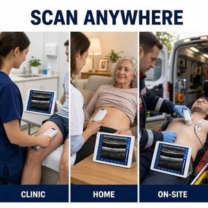 Échographe portable sans fil compatible iOS et Android, sonde Doppler couleur de poche pour l'imagerie abdominale et obstétricale - Product Image 3
