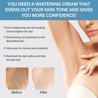 Crème Éclaircissante pour la Peau Contre l'Acanthosis Nigricans, Élimine les Taches Noires, Correcteur de Taches Foncées, Pour Genoux, Coudes, Aisselles et Cou