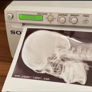 Medical High Glossy Thermal Carbon-Less Printing <b>Paper</b> Roll UPP-110HG Pure White Ultrasound <b>Paper</b> for Printer - Product Image 6