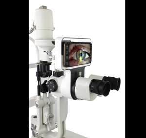 Nuevo Módulo de Imagen Oftálmica para Lámpara de Hendidura, Adaptador de Imagen para Instrumentos Ópticos Digitales Phonto/Phoenix - Product Image 5