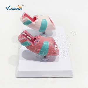 Suministro directo de fábrica de modelos de patología traqueal, hechos de material de PVC ecológico, claramente identificados, para laboratorio. - Product Image 3