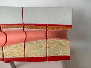 एनाटोमिकल चिकित्सा विज्ञान मानव संवहनी घावों प्रदर्शन मॉडल संवहनी ओक्शन मॉडल - Product Image 3